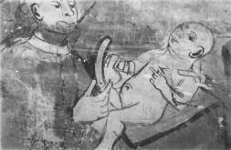 Circuncision. Mata de Hoz